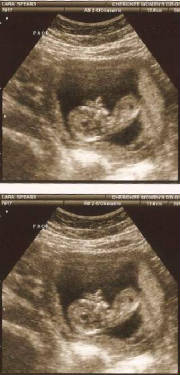 3moultrasound2-2-09body.jpg