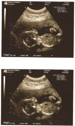 Baby4months.jpg