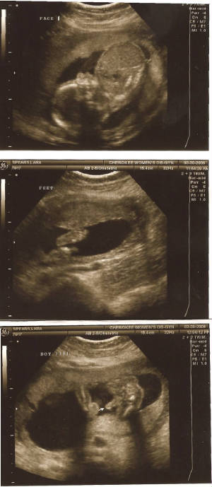 BabyBoy5months.jpg